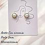 ARETES DE MICROCIRCONIA
